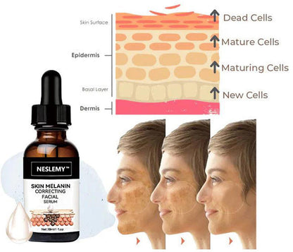 ✨Last Day Discount: 87%OFF-NESLEMY™  Remove freckle Facial Serum