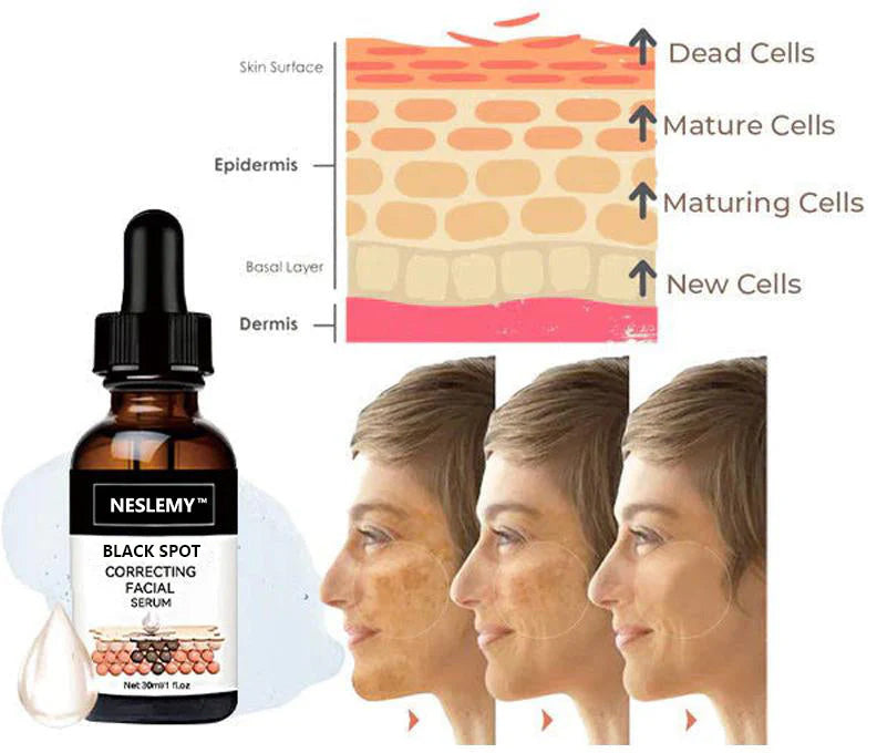 ✨Fast Dark Spot Remover-NESLEMY™ BLACK SPOT Correcting Facial Serum