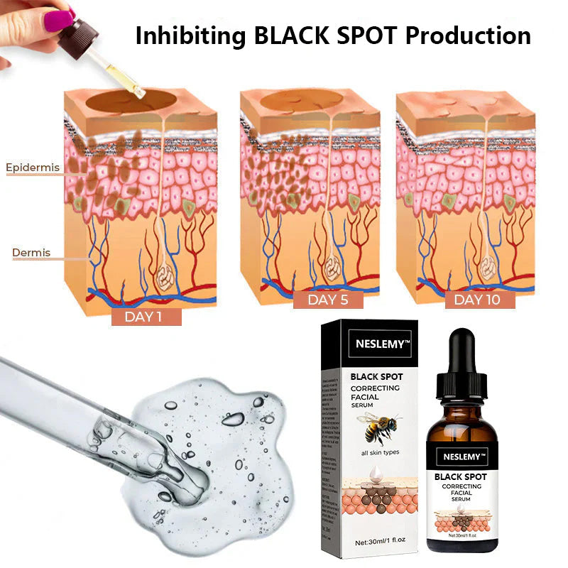 ✨Fast Dark Spot Remover-NESLEMY™ BLACK SPOT Correcting Facial Serum