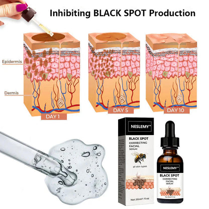 ✨Fast Dark Spot Remover-NESLEMY™ BLACK SPOT Correcting Facial Serum