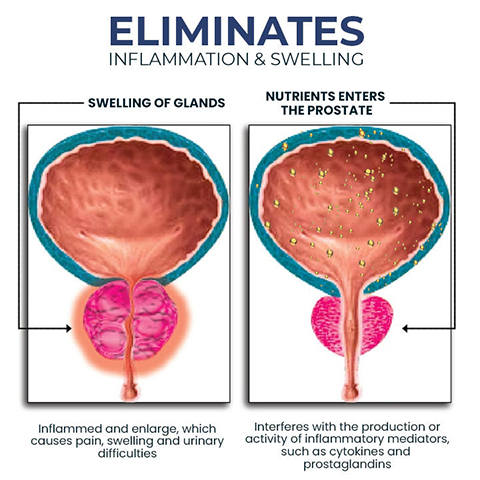 NESLEMY™ BeeBoom NASAL INHALER FOR PROSTATE WELLNESS