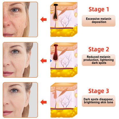 NESLEMY™ Purifying Exfoliating Gel for Acanthosis Nigricans, Exfoliation, Dark Spots, Skin Tags, and Eczema