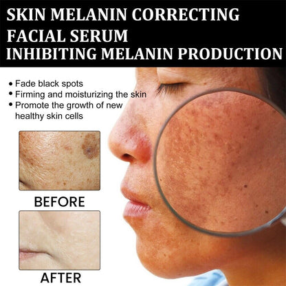 ✨Last Day Discount: 87%OFF-NESLEMY™  Remove freckle Facial Serum